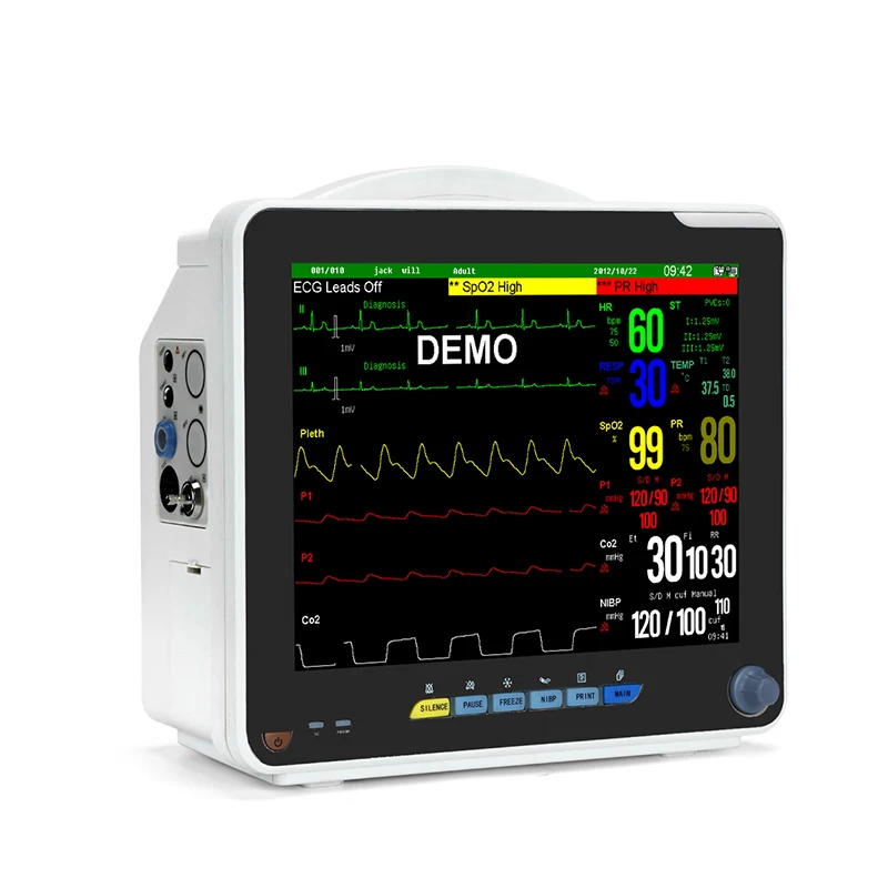 Monitor (6).jpg