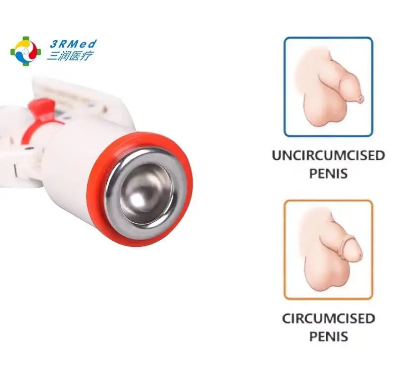

3R Painless Circumcision Device Surgical Circumcision Clamp