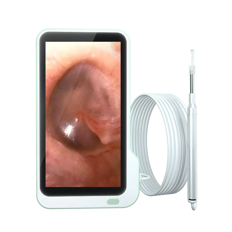 

Timesiso P50 3.9mm 3MP 5 Inch HD IPS Screen Handheld Visual Ear Spoon Endoscope Camera Ear Otoscope Camera with Button