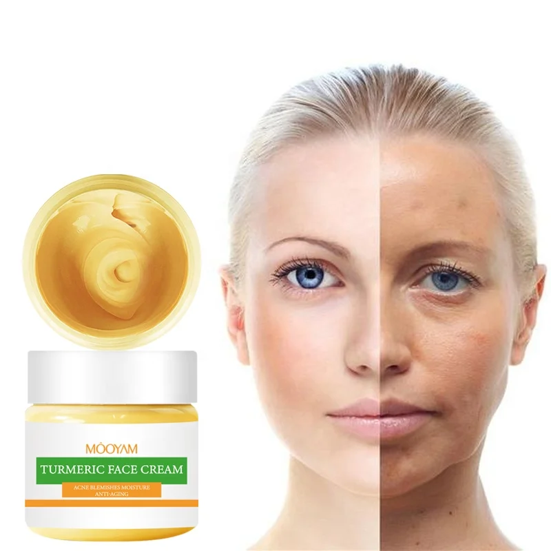 

Private Label Skin Care Pimple Remover Face Cream Acne Treatment Whitening Dark Spot Removal Anti-Aging Turmeric Cream, Yellow