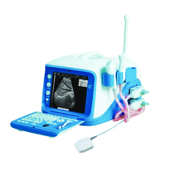 Full Digital Portable Ultrasound Scanner Machine