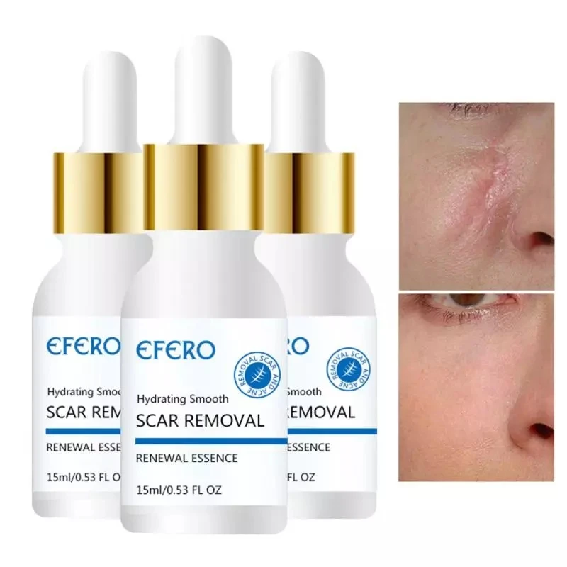 

Efero Scar Remove Essence Acne Treatment Blackhead Removal Anti Acne Cream Oil Control Shrink Pores Acne Face Care Whitening