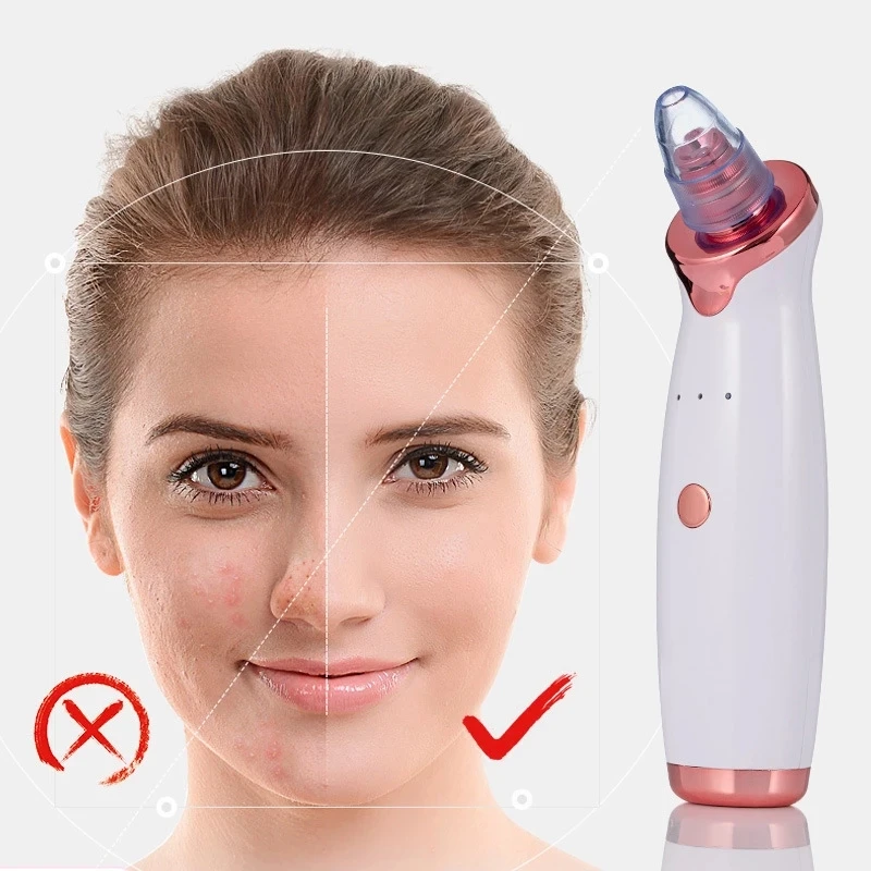 

Vacuum Pore Cleaner Black Head Suction Hot Blackhead Remover Extractor Tool Electric Vacuum Suction