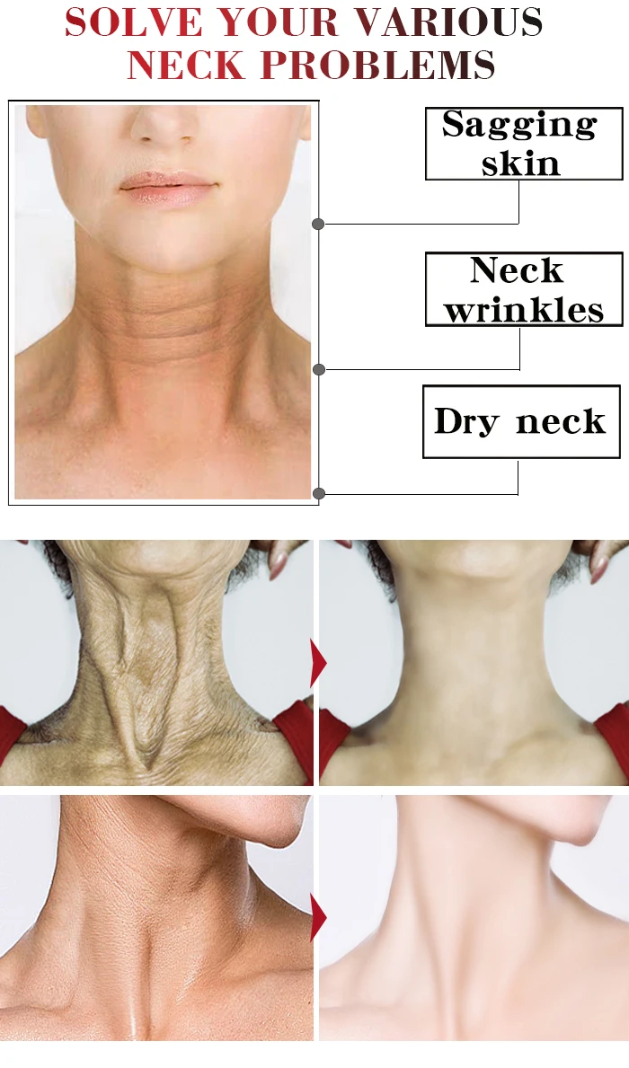 neck whitening cream for men