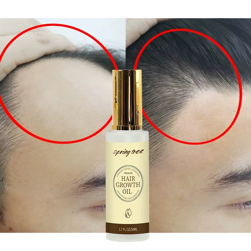 

Private Label hair growth oil serum for hair growing treatment