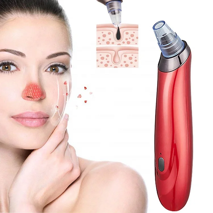 

Blackhead Remover Vacuum Blackhead Removal Peel Tool Extractor Electric Skin Pore Suction Cleaner Comedone Acne Eliminator, Chinese red/ivory white/glossy black