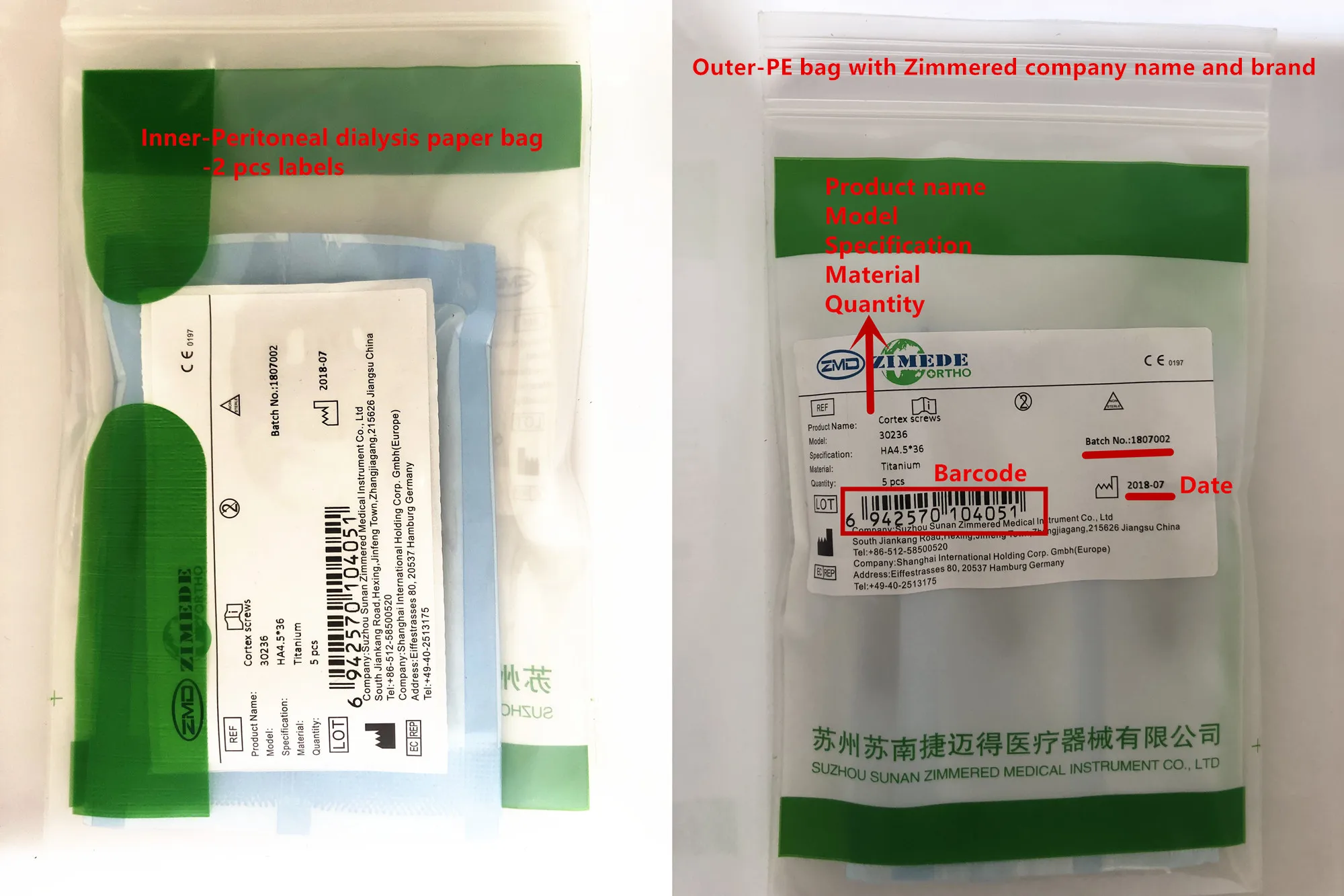 High tech osteosynthesis 08 image