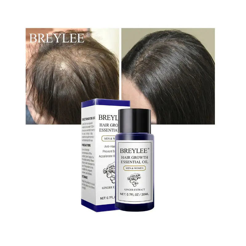 

BREYLEE Organic Ginger Hair Growth Essential Oil Hair Loss Treatment Serum Free Shipping