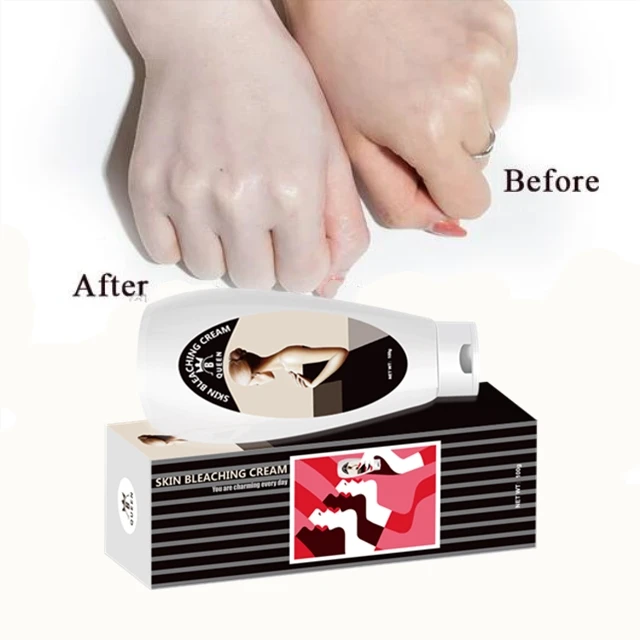 

Wholesale Natural Black Skin Whitening Bleaching Cream, Milk white