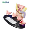 Factory Price Advanced Anatomical Four-stage Prostate Cancer Model with Male Pelvic Anatomy