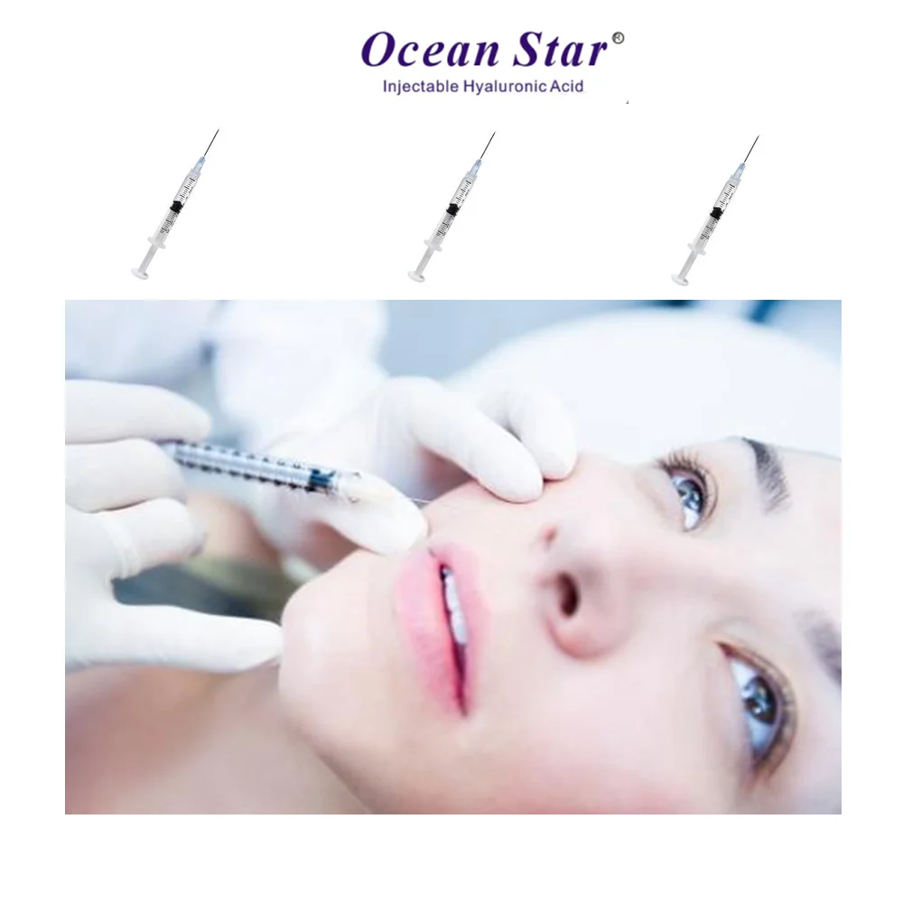 

Ocean Star 1ml Derm dermal filler injection hyaluronic acid for lip, N/a