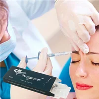 

Hyaluronic acid dermal filler injectable neuramis 2ml dermal filler injection