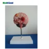 Brain Stroke Model Cerebral Palsy Brain Tumor Brain Disease Model
