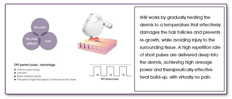 
best price ipl pigment treatment home use beauty machine 