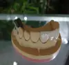 dental crown denture or false teeth porcelain false teeth