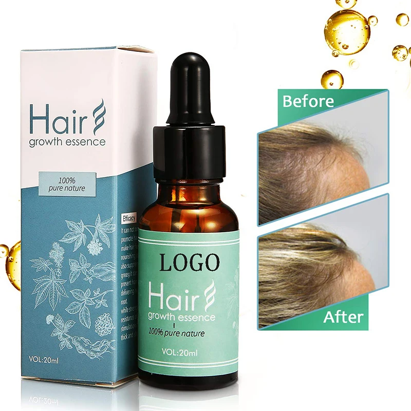 Oem Hair Loss Prevention Treatment Essence Natural Hair Growth