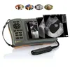 Cheapest good quality digital veterinary ultrasound machine for all animals