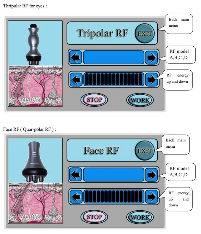 fat brain vacuum