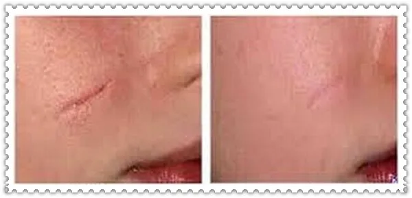 beforeafter.jpg