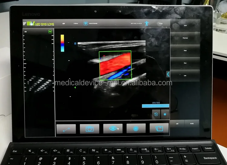 High Frequency 10mhz Linear Array Wifi Ultrasound,Multifrequency 5