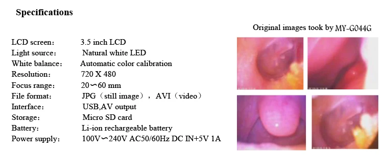 Digital Otoscope_03.jpg