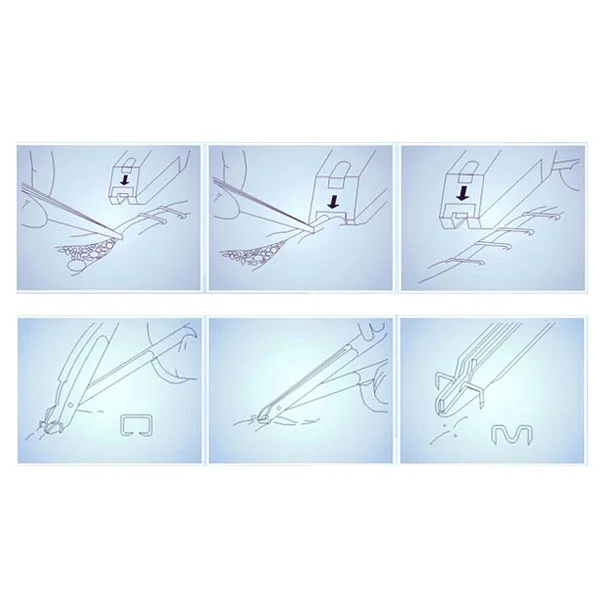 
High Quality 35W Disposable Skin Stapler With CE 