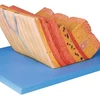 Gastric wall enlargement model Local model of stomach