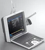 B36 portable 15Mhz linear MSK ultrasound machine / gray cover beautiful design medical ultrasound scanner