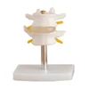 Medical teaching lumbar vertebrae set model (2 pcs) made in china with ce certificate models for teaching