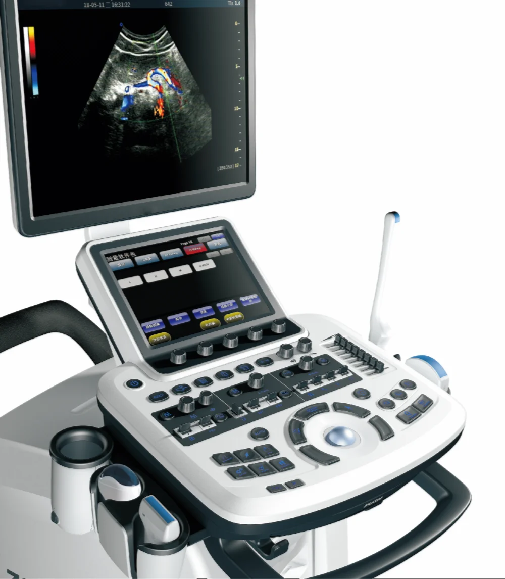 Digital Trolley 3d 4d Ultrasound Scanner Usg Mesin Mslcu47 Buy Ultrasound Usg Trolley Usg 3d Product On Alibaba Com Digital Trolley 3d 4d Ultrasound Scanner Usg Mesin Mslcu47 Buy Ultrasound Usg Trolley Usg 3d Product On Alibaba Com