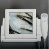 AYJ-J015(CE) Newest 5MP digital hair wood lamp body skin hair analyser/3d skin analyzer/hair detector