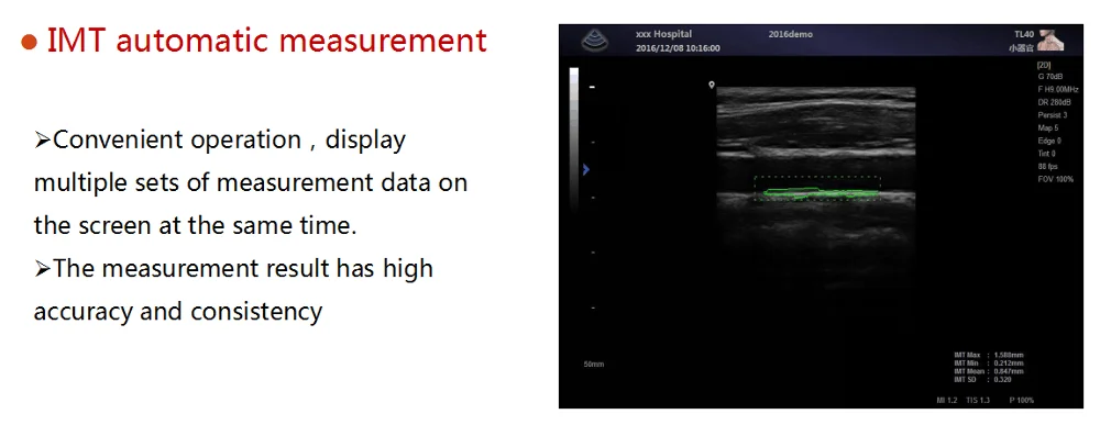 Ultrasonic USG ultrasound Scanner portable ultrasound usg