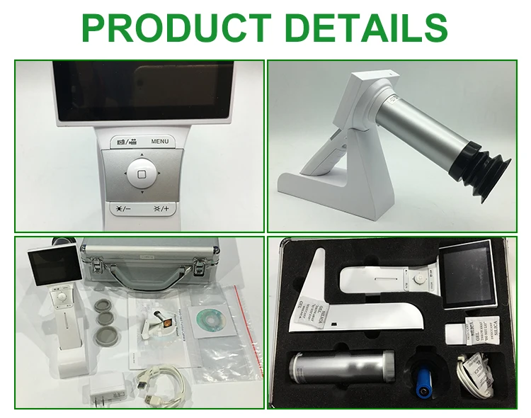 handheld fundus camera