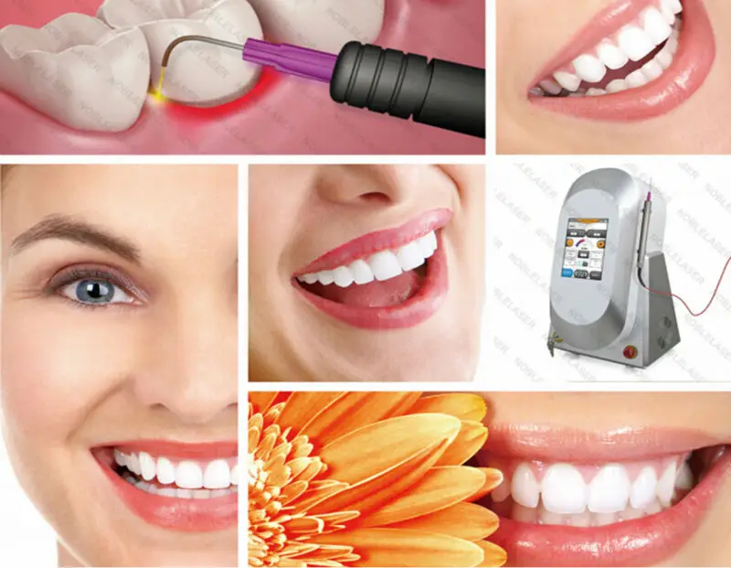 Teeth Whiten Laser Machine Dental Diode Laser Portable Dental Laser