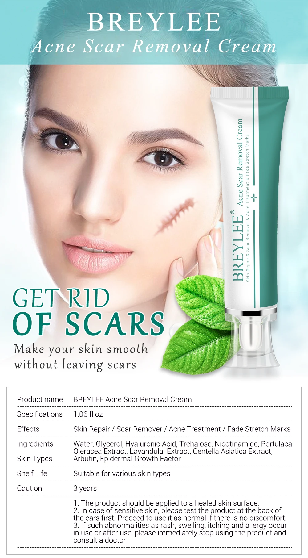 instant acne removal cream