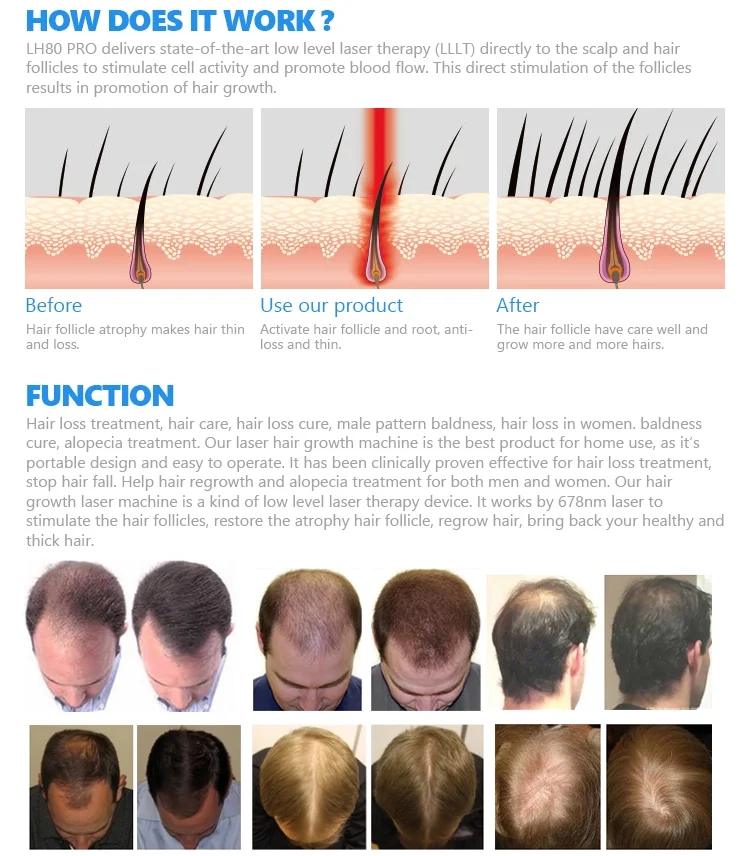 Regrowth Growing Regrow Laser Hair Growth Helmet