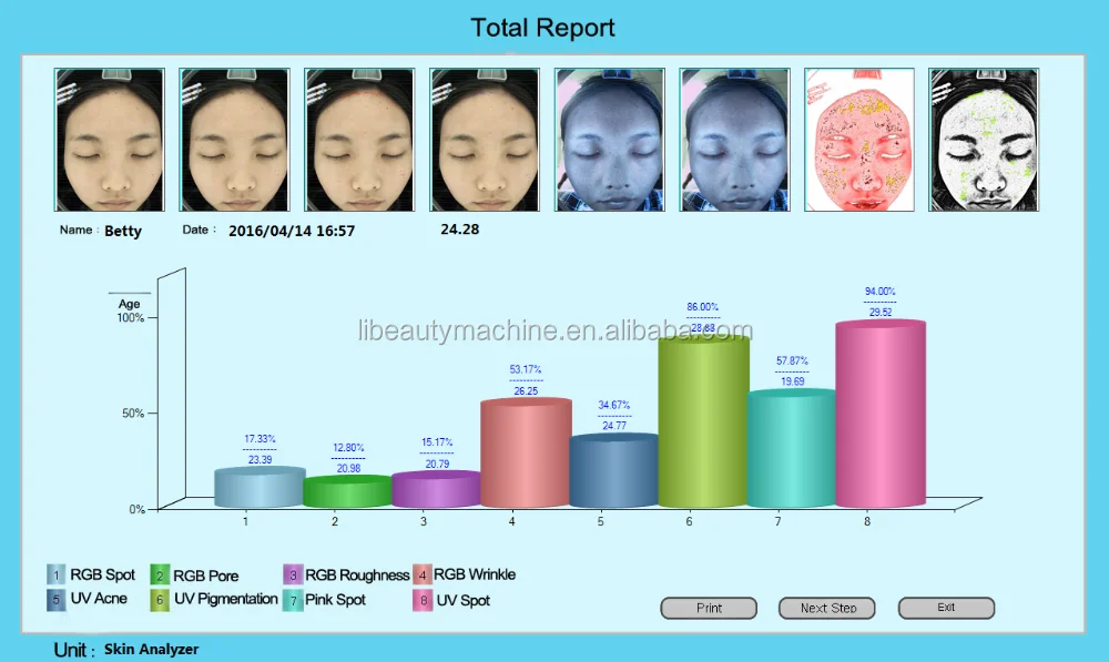 Magic Mirror Facial Skin Analyser Analyzer 5.png