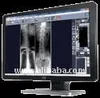 Vision Tools WebView for Radiology