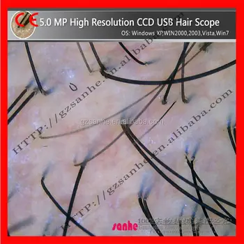 Beauty Equipment China Best Hair Analysis Hair Care Products