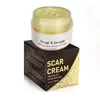 Private Label Korea Anti Acne Scar And Stretch Marks Face Cream
