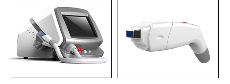 laser hair removal germany