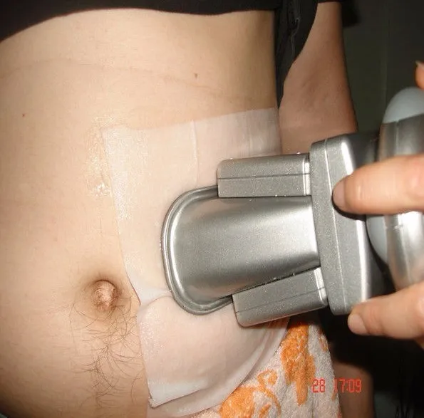 Etg 50 4s Kryotherapie Fett Einfrieren Maschine Mit Deutsch Pumpe