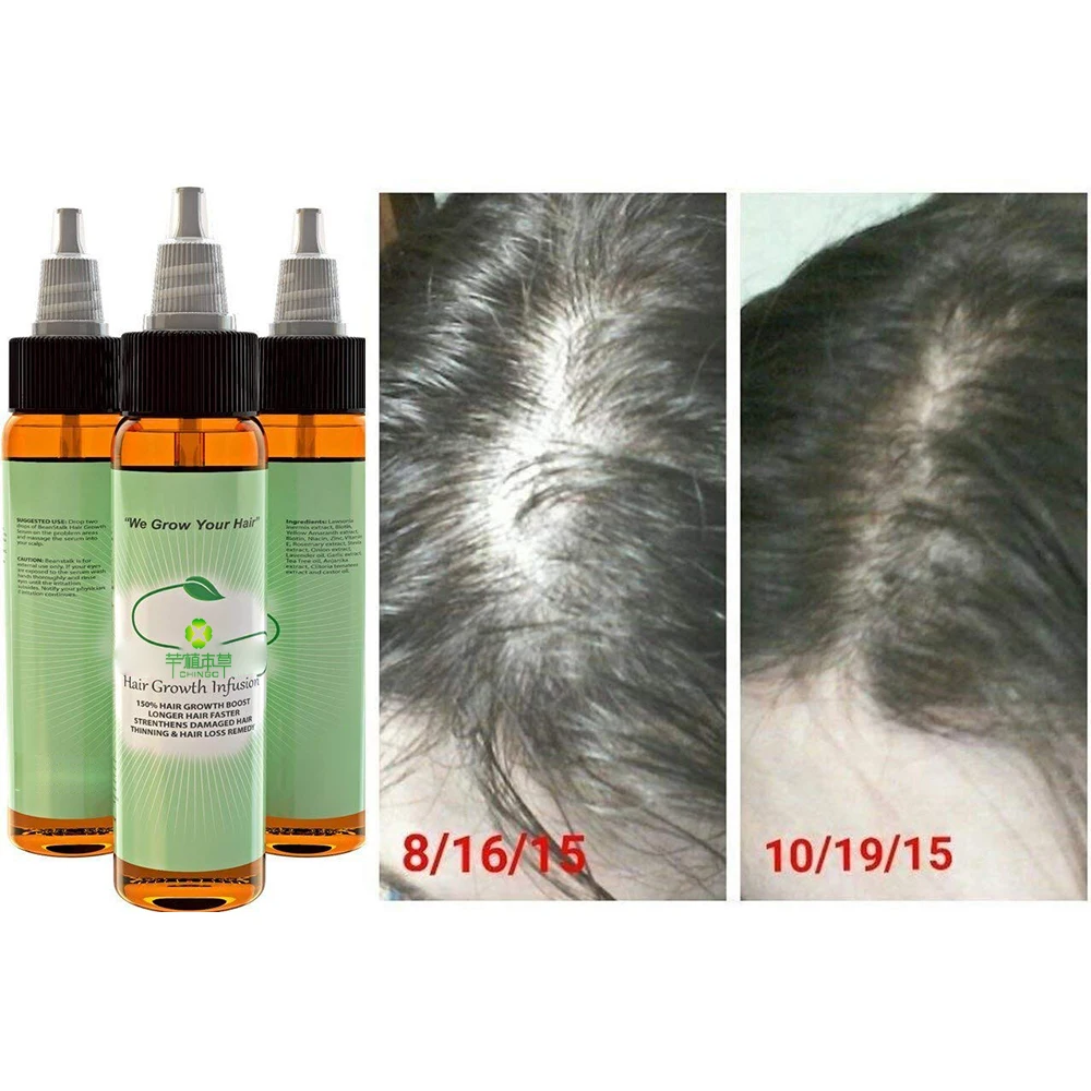 Herbal Amla Indulekha Hair Oil Liquid