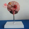 Medical anatomical model Brain pathologies model