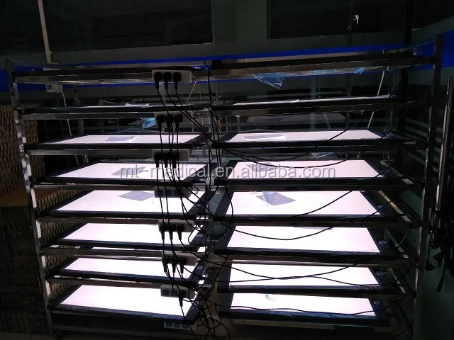 Medical LED X-ray Negatoscope X-ray Film Viewer Price for Sale