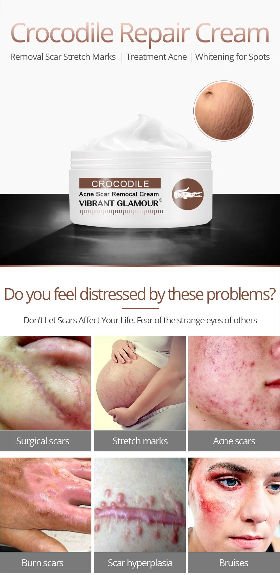 crocodile scar cream