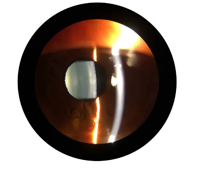 专业类型眼科光学设备数字裂隙灯ls