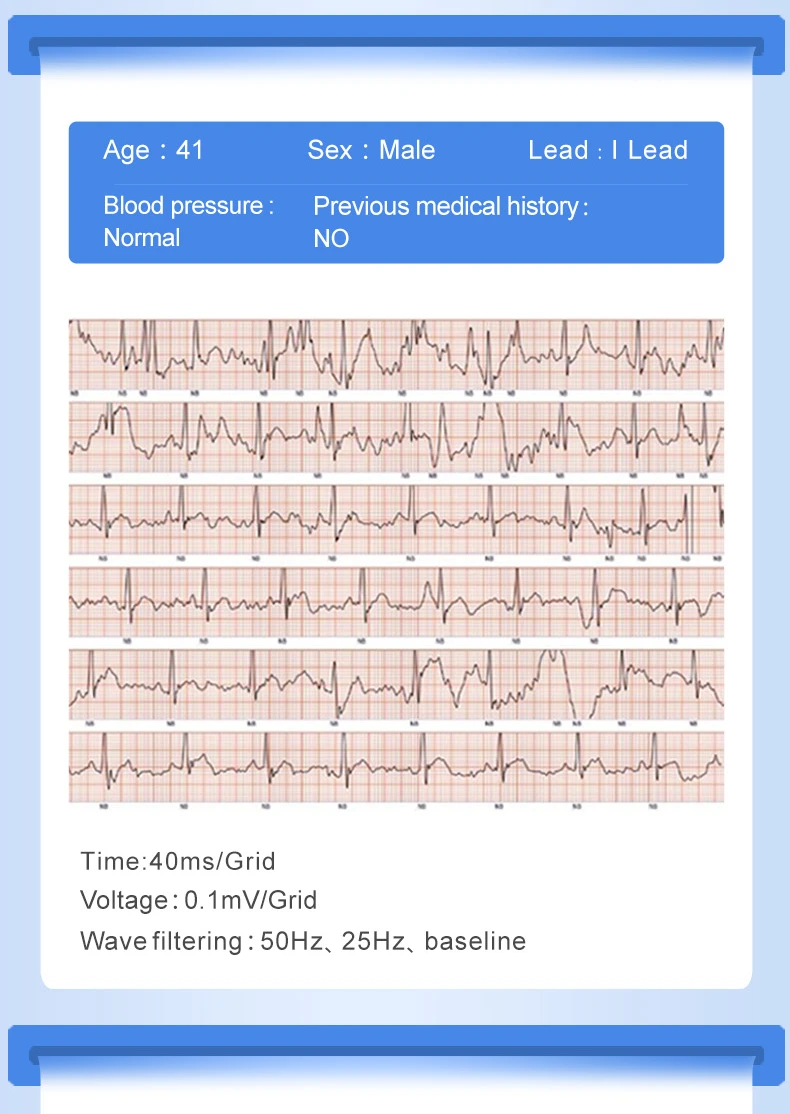 P3 Plus Smart Bracelet PPG ECG Heart Rate Blood Pressure Monitor Color Screen Smart Band-04.jpg
