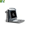 Chison Eco1 Black and white portable Ultrasound Scanner,chison eco1 ultrasound best price