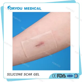 silicone for scar healing